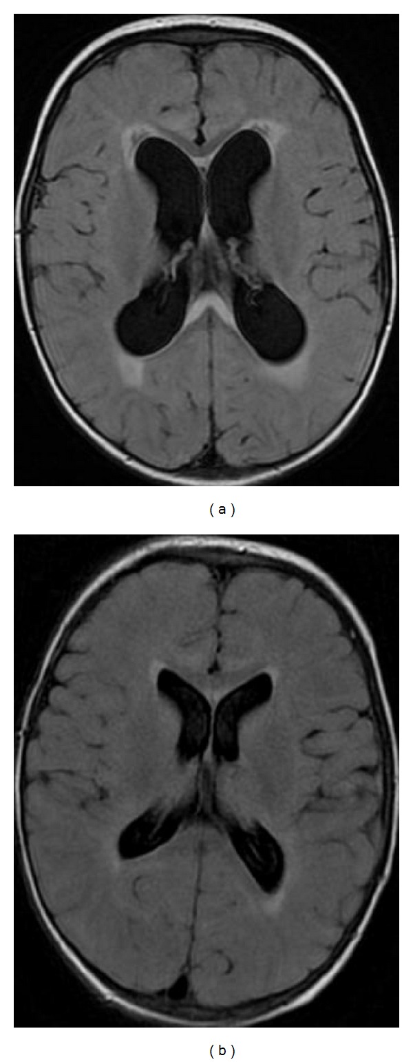 Figure 36