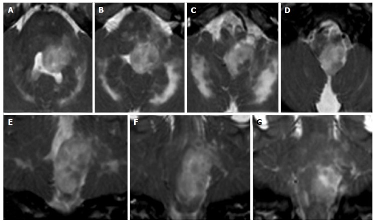 Figure 19