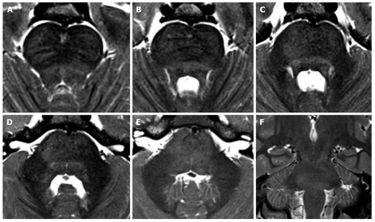 Figure 20