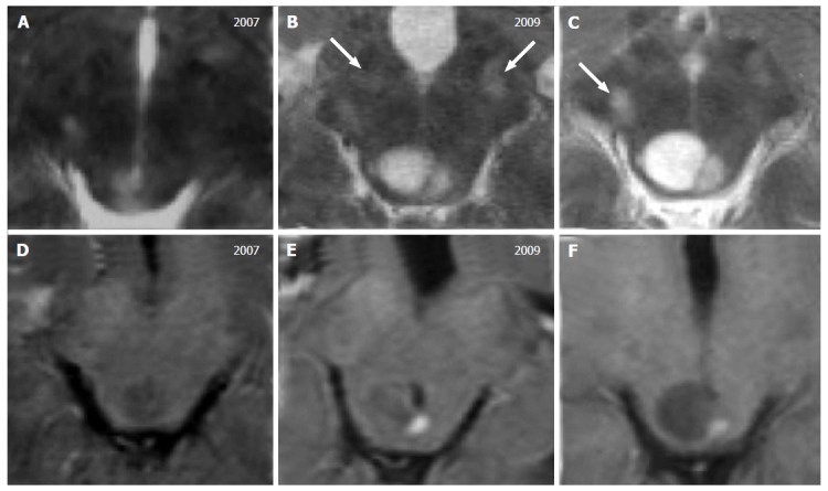 Figure 17