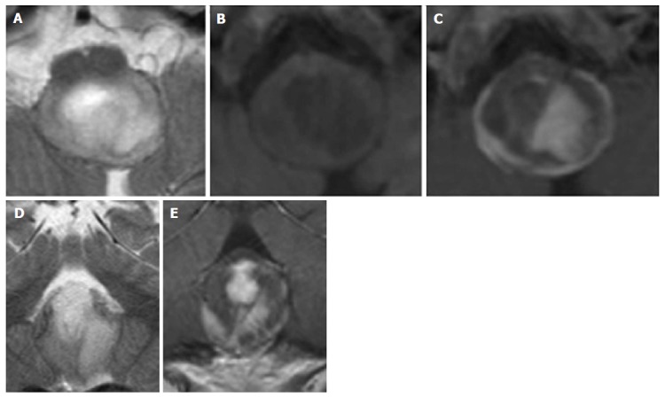 Figure 16