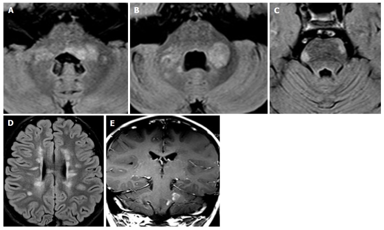 Figure 14