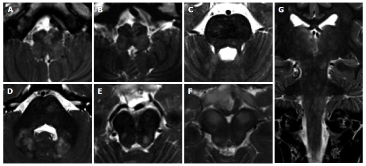 Figure 18