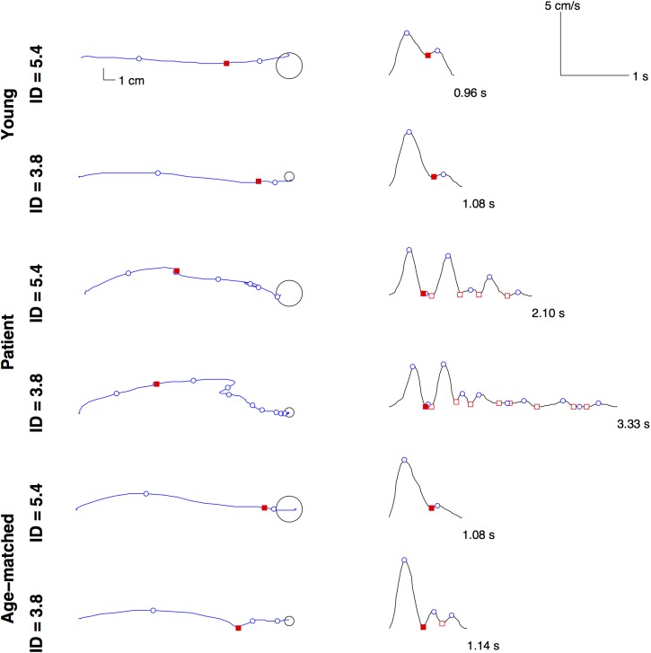 Fig 4