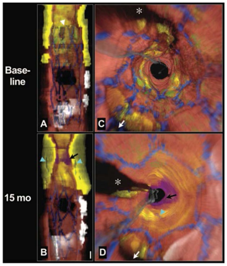 Fig. 13