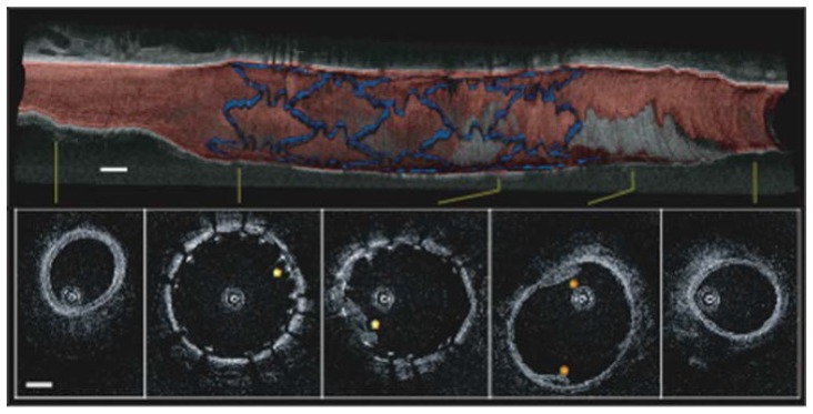 Fig. 10