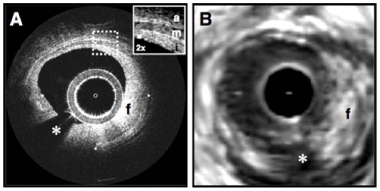 Fig. 6