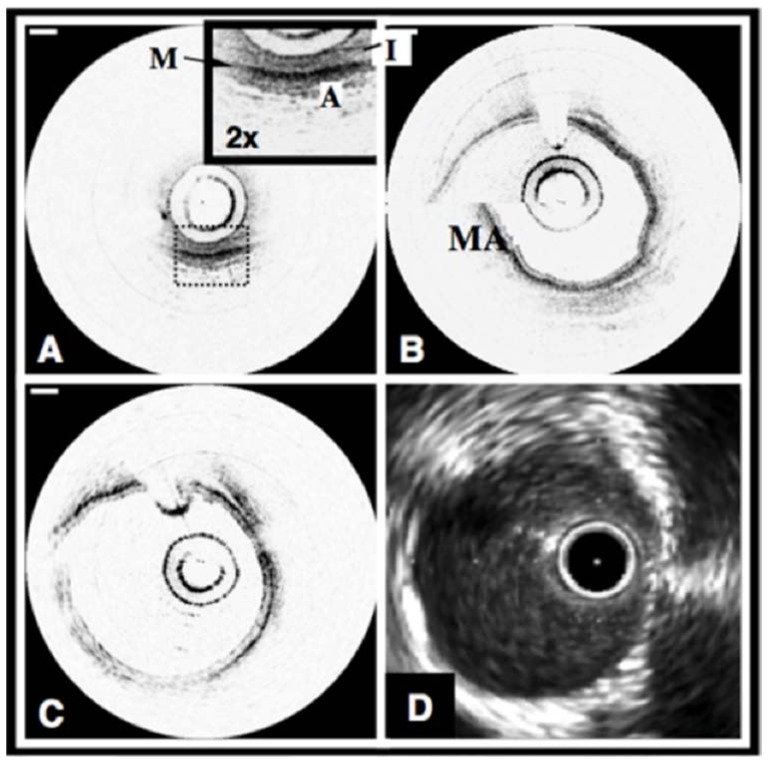 Fig. 5