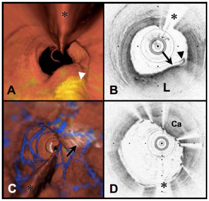 Fig. 11