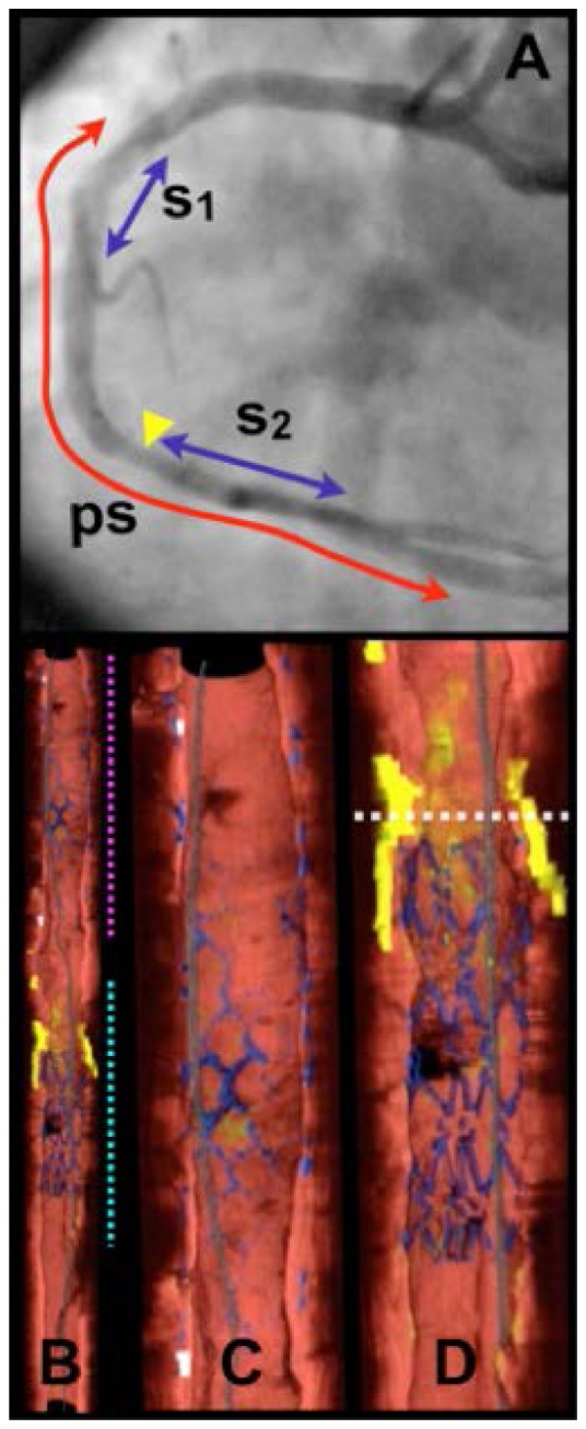 Fig. 12