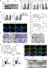 Figure 6. HIF2α regulated FA anabolism by inhibiting MLYCD expression. A, Representative images of Western blotting for detecting MLYCD and HIF2α expression in OS-RC-2 and 786-O cells with/without HIF2α knockdown (shHIF2α) and/or MLYCD knockout (sgMLYCD). B, Levels of malonyl-CoA, de novo FA synthesis, and CPT1A activity in cells with/without HIF2α knockdown and/or MLYCD knockout. C, Levels of FFA and TG in cells with or without HIF2α knockdown and/or MLYCD knockout. D, Representative fluorescence images of LDs stained with BODIPY 493/503 (green) and nuclei stained with DAPI (blue) in cells with or without HIF2α knockdown and/or MLYCD knockout. E and F, CCK-8 and Transwell assays to assess the effect of HIF2α knockdown and/or MLYCD knockout on cell proliferation and invasion. G, Representative TEM images of mitochondria in OS-RC-2 cells with or without HIF2α knockdown and/or MLYCD knockout. Red arrows, mitochondria. Green arrows, endoplasmic reticulum. H, OCR measurement in OS-RC-2 cells with or without HIF2α knockdown and/or MLYCD knockout. I, Representative fluorescence imaging of lipid-derived ROS (red) and mitochondria (green) in OS-RC-2 cells with or without HIF2α knockdown and/or MLYCD knockout. J, The percentage of dead cells was detected by the CCK8 assay after treatment with erastin (10 μmol/L) for 48 hours. K, Representative images of Western blotting for detecting the expression of ferroptosis marker genes and PLIN2 in cells with/without HIF2α knockdown and/or MLYCD knockout. Student t test; ns, not significant; *, P < 0.05; **, P < 0.01; ***, P < 0.001.