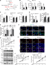 Figure 3. MLYCD inhibited de novo FA synthesis by reducing malonyl-CoA content, ultimately induced cell death via increasing ER stress. A, Schematic illustration of the key role of MLYCD in FA anabolism. B and C, Levels of malonyl CoA, FFA, and TGs in OS-RC-2 and 786-O cells with/without overexpression (B) or knockout expression (C) of MLYCD. D and E, Level of de novo FA synthesis in different RCC cells was measured by [14C] acetate incorporation into lipids. F, Representative fluorescence imaging of LDs stained with BODIPY 493/503 (green) and nuclei stained with DAPI (blue) in OS-RC-2 and 786-O cells with/without MLYCD overexpression and/or malonyl CoA (10 μmol/L) for 24 hours. G, CCK-8 assay for assessing the cell proliferation of 786-O cells with/without MLYCD overexpression and/or malonyl-CoA (10 μmol/L). H, Representative fluorescence imaging of ER tracker (red) staining to assess the ER stress expansion in OS-RC-2 and 786-O cells with/without MLYCD overexpression. Nuclei were stained with DAPI (blue). I, Representative imaging of Western blot analysis for detecting the expression of ER stress markers in OS-RC-2 and 786-O cells with/without MLYCD overexpression. J, CCK-8 assay for assessing the cell proliferation of OS-RC-2 and 786-O cells with/without MLYCD overexpression (B) and/or 4-PBA (10 μmol/L). ns, not significant; *, P < 0.05; **, P < 0.01; ***, P < 0.001.
