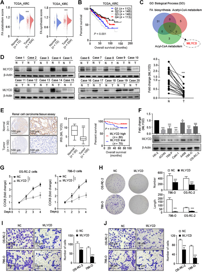 Fatty Acid Oxidation Mediated by Malonyl-CoA Decarboxylase Represses ...