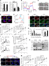 Figure 4. MLYCD restoration resulted in mitochondrial damage, ROS elevation, and cell activity inhibition via enhancing CPT1A activity. A, CPT1A activity measurement in OS-RC-2 and 786-O cells with/without MLYCD overexpression (left) or knockout (right). B, OCR in OS-RC-2 cells with MLYCD restoration and the control cells. Oligo, oligomycin; FCCP, carbonyl cyanide 4-trifluoromethoxy-phenylhydrazone. C, Representative TEM imaging of the mitochondria in OS-RC-2 and 786-O cells with/without MLYCD restoration. Red arrows, mitochondria. D, Representative fluorescence imaging of mitochondria (red) and nuclei (blue) in OS-RC-2 cells with/without MLYCD overexpression and/or malonyl-CoA (10 μmol/L). E, Total intracellular ROS production was assessed by flow cytometry using DCFH-DA. F, Representative fluorescence imaging of lipid-derived ROS (red) detected with BODIPY 665/676 and mitochondria (green) in OS-RC-2 cells with/without MLYCD restoration and/or CPT1A inhibitor ETO (2 μmol/L). G, CCK-8 assay for assessing the cell proliferation of OS-RC-2 and 786-O cells with/without MLYCD overexpression and/or ETO (2 μmol/L). H, The levels of the unsaturated bonds in lipid based on the absolute quantitative lipidomics (left). The degree of lipid peroxidation was assessed by the malondialdehyde measurement in cells. I and J, Dead cell percentage and cell proliferation was measured after erastin (10 μmol/L) for 48 hours and Ferr-1 (20 μmol/L) treatment by CCK8 assay, respectively. K, Representative imaging of Western blot analysis for detecting the expression of ferroptosis marker genes in OS-RC-2 or 786-O cells with/without MLYCD overexpression (left) or knockout (right). L, Representative fluorescence imaging of lipid-derived ROS (red) detected with BODIPY 665/676 and nuclei (blue) in OS-RC-2 and 786-O cells with/without MLYCD restoration and/or ROS scavenger NAC (10 μmol/L). M, CCK-8 assay for assessing the cell proliferation of OS-RC-2 and 786-O cells with/without MLYCD overexpression and/or NAC (10 μmol/L). Student t test; ns, not significant; *, P < 0.05; **, P < 0.01; ***, P < 0.001.