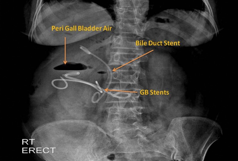 Fig. 5.