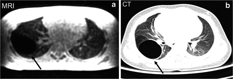 Fig. 13