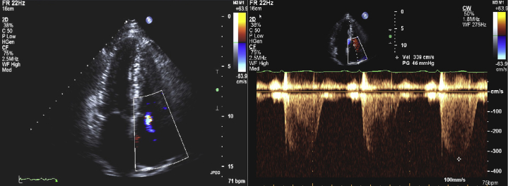 Figure 3