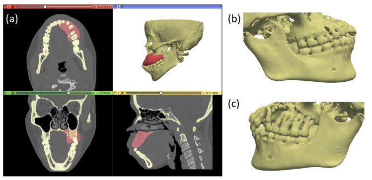 Figure 10