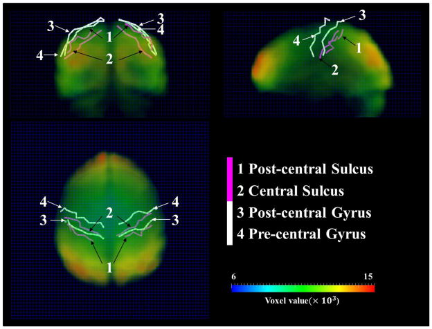 Figure 11