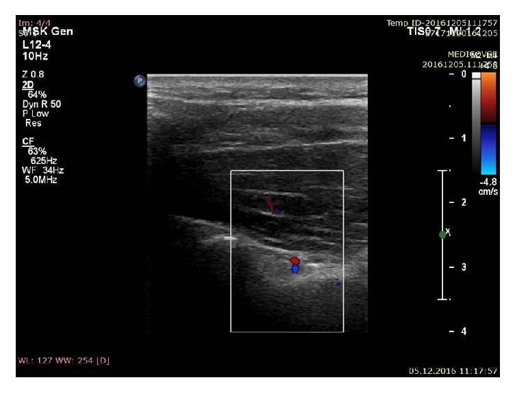 Figure 5