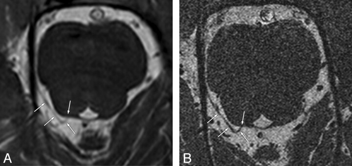 Fig 1.