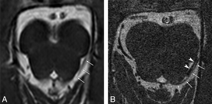 Fig 4.