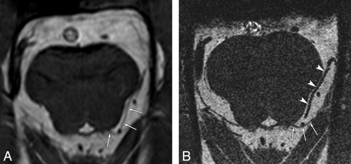 Fig 3.