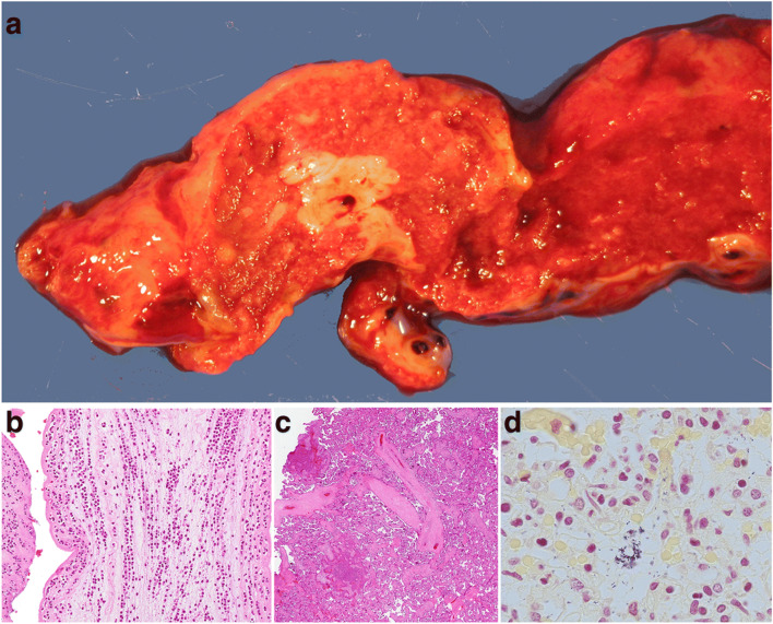 Fig. 16