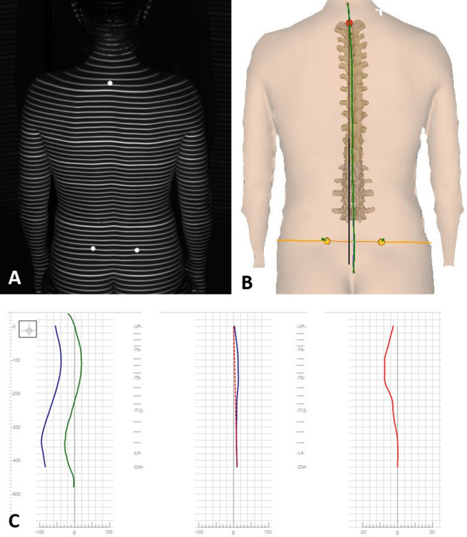 Fig. 2