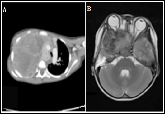 Fig.1