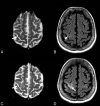 Fig 4.