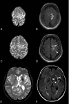 Fig 3.