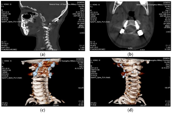 Figure 11