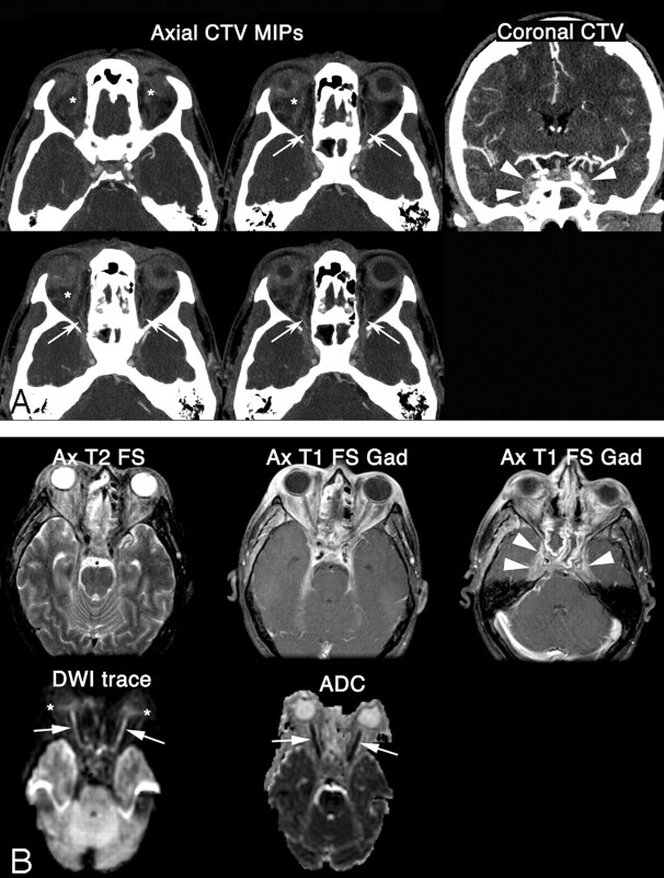 Fig 1.