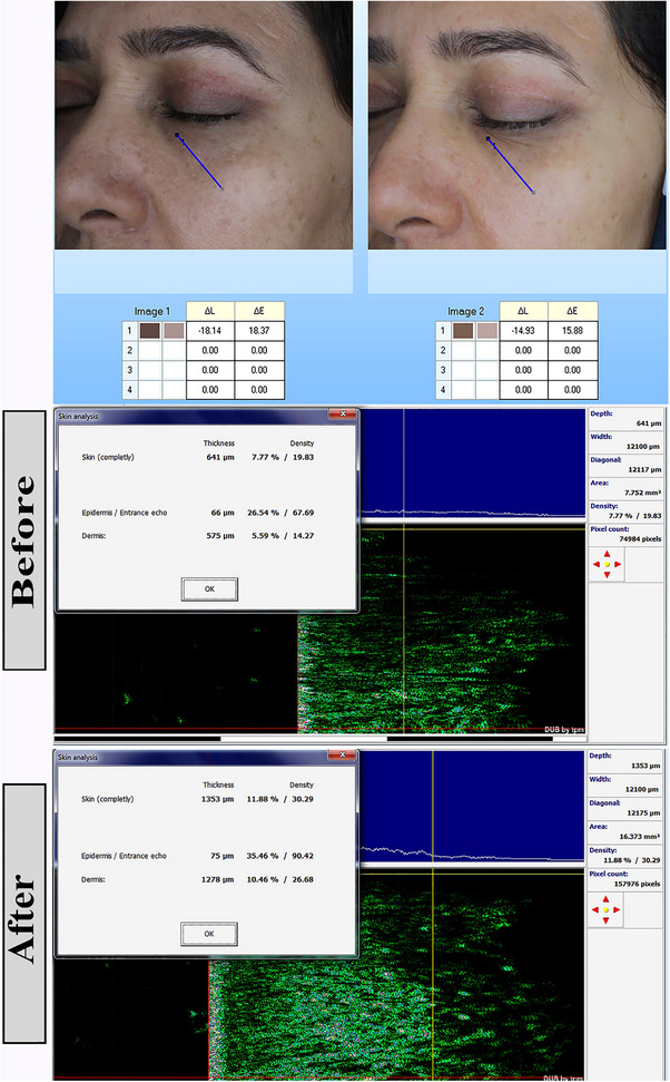 FIGURE 3