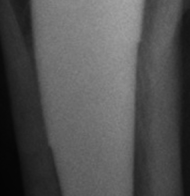 Fig. 3