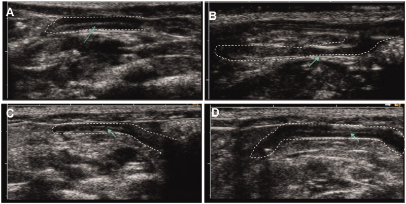 Figure 3.