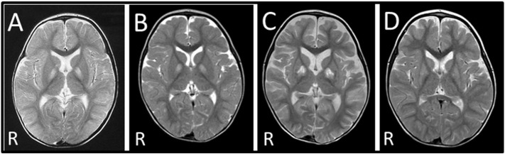 Fig. 1