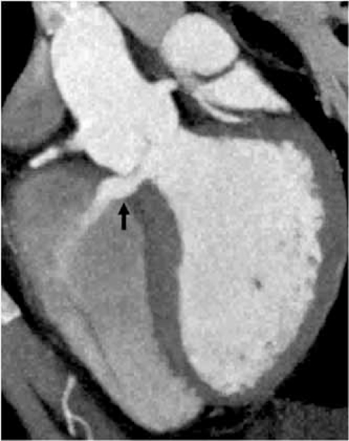 Fig. (10B)