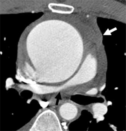 Fig. (13A)