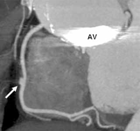 Fig. (8A)