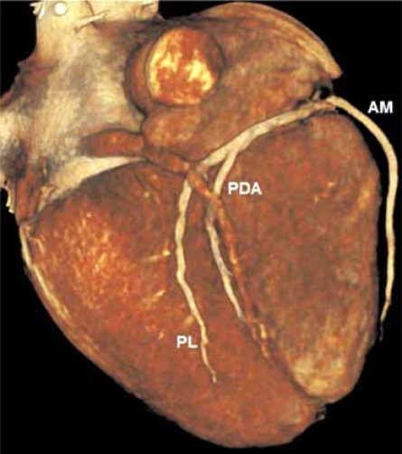 Fig. (7A)