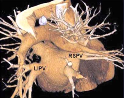 Fig. (12)