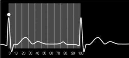 Fig. (2)