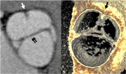 Fig. (11B)