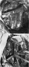 214-3