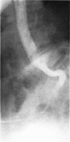 214-3
