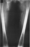 214-3