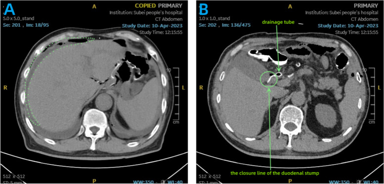 Fig. 6