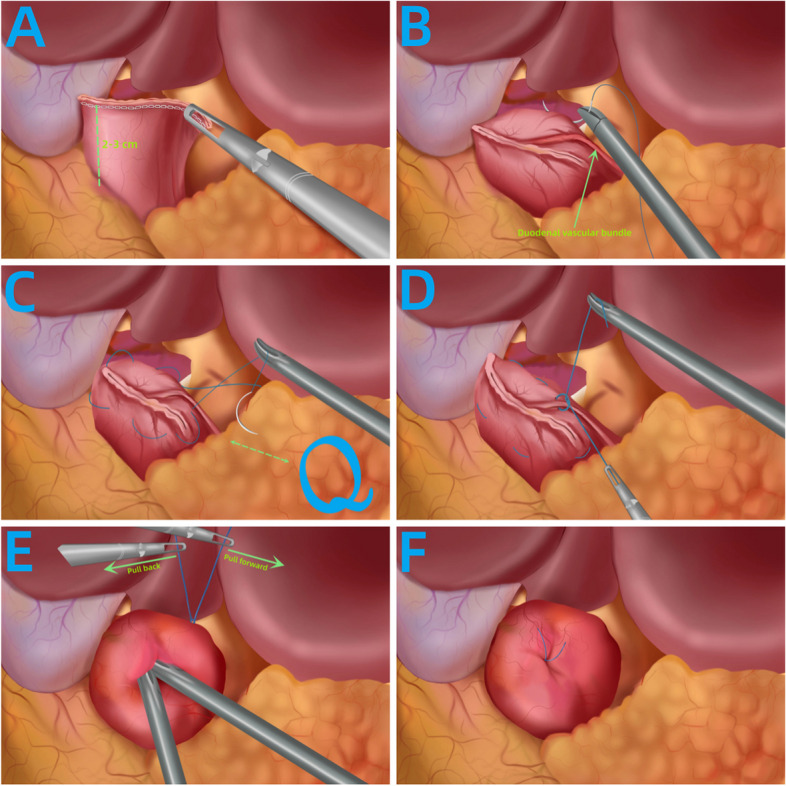 Fig. 3